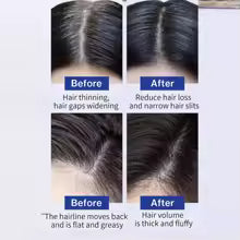 FEG HAIR GROWTH OIL