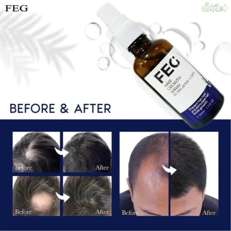 FEG HAIR GROWTH OIL