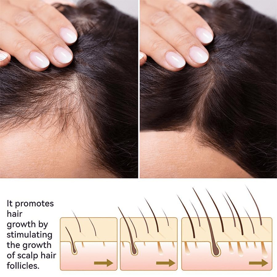 FEG HAIR GROWTH OIL
