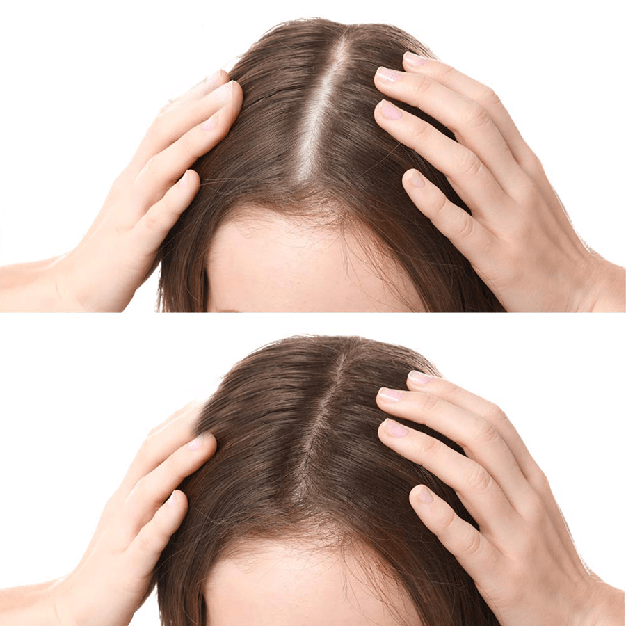FEG HAIR GROWTH OIL